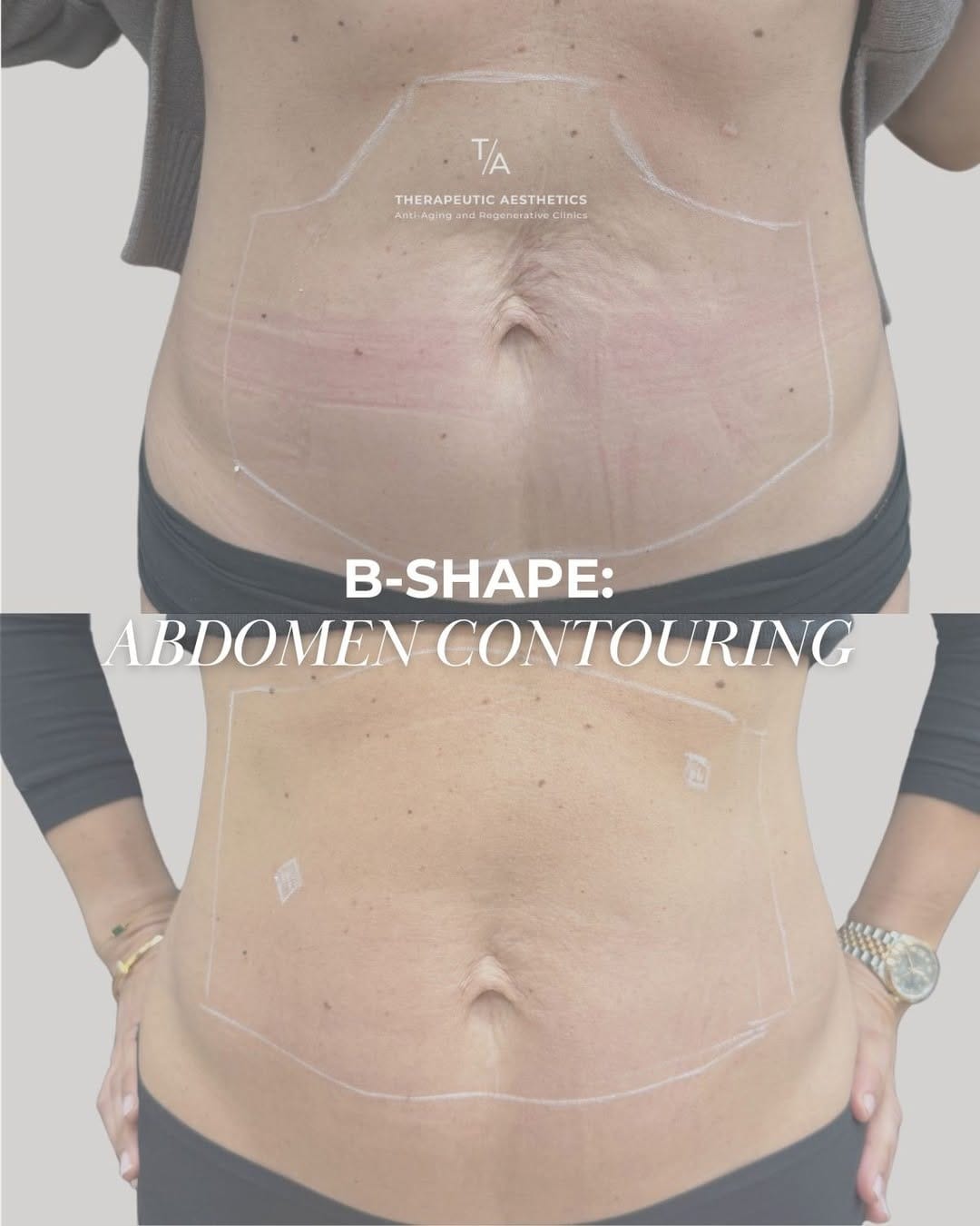 Post 9 by Therapeutic Aesthetics on Instagram (carousel)