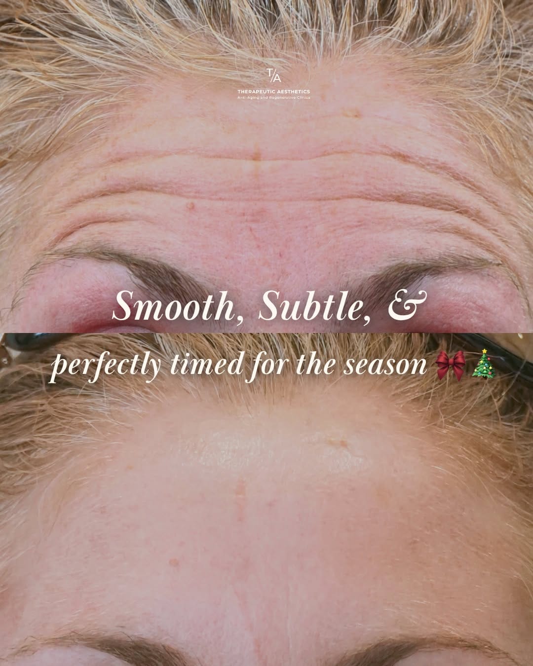 Post 2 by Therapeutic Aesthetics on Instagram (carousel)