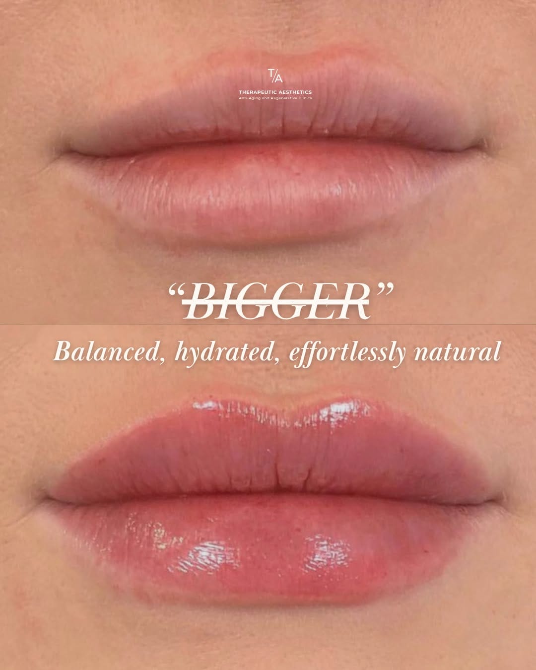 Post 7 by Therapeutic Aesthetics on Instagram (carousel)