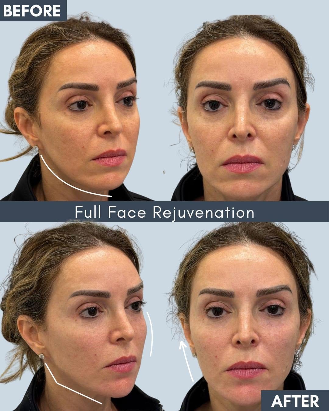 Post 3 by Aesthetics & Skin Clinic on Instagram (image)