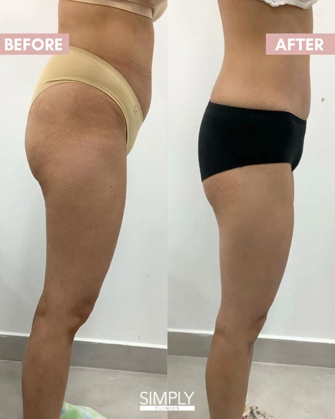 Post 8 by Aesthetics & Skin Clinic on Instagram (image)