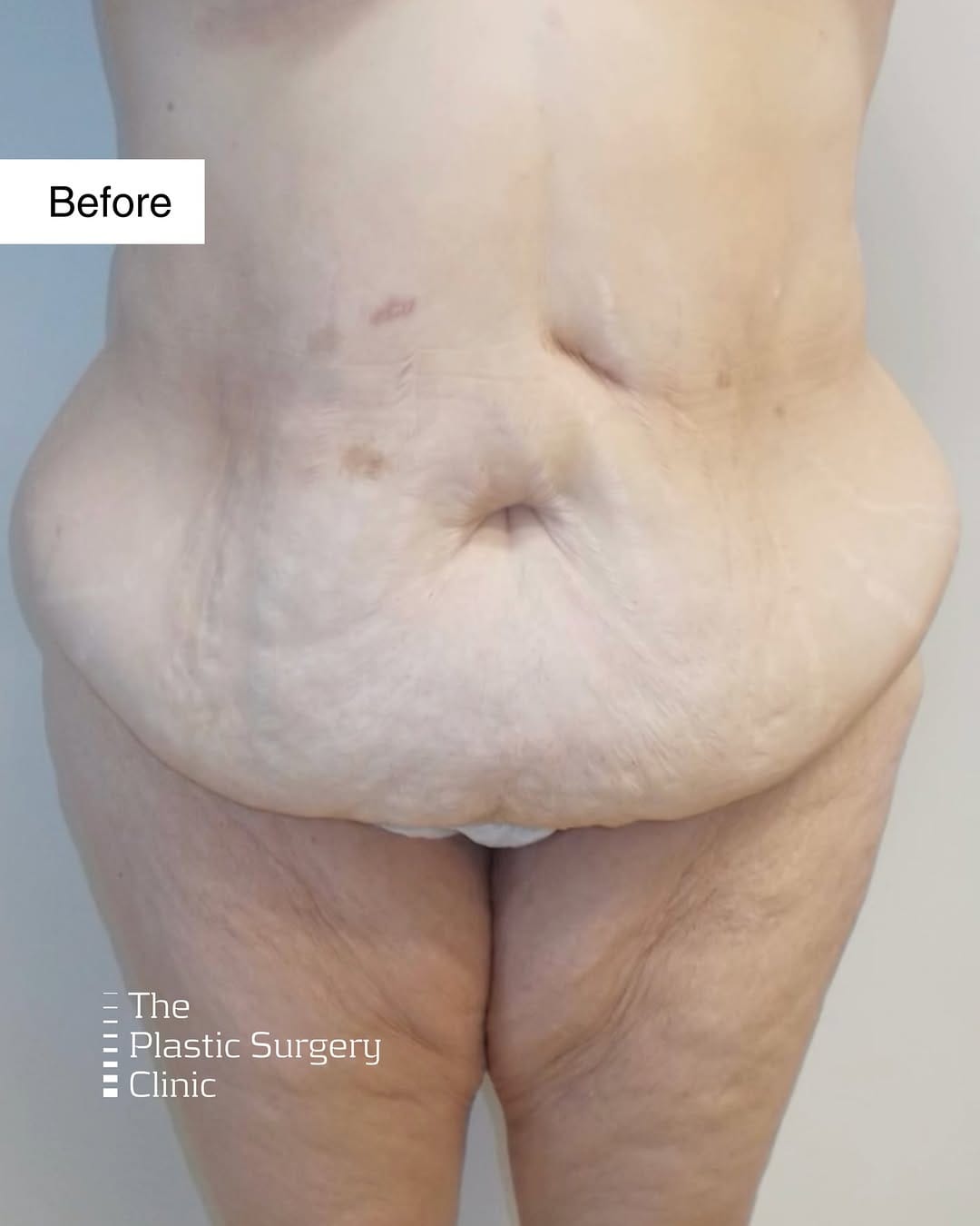 Post 1 by The Plastic Surgery Clinic on Instagram (carousel)