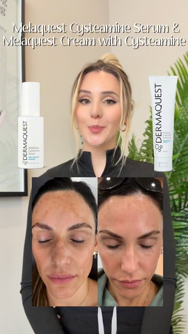 Post 7 by LumaPharm Brands - Aesthetic Distribution 🇨🇦🇺🇸 on Instagram (video)