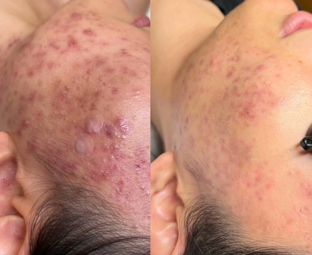 Post 8 by 🇨🇦Holistic Esthetician & Product Formulator on Instagram (image)
