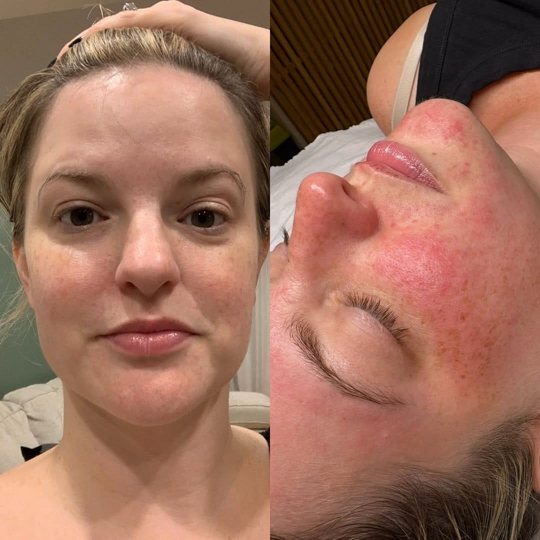 Post 1 by 🇨🇦Holistic Esthetician & Product Formulator on Instagram (image)
