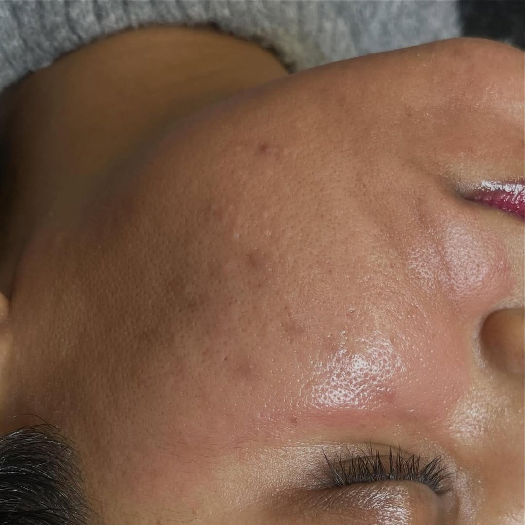 Post 1 by Exclusive Look Esthetics on Instagram (carousel)