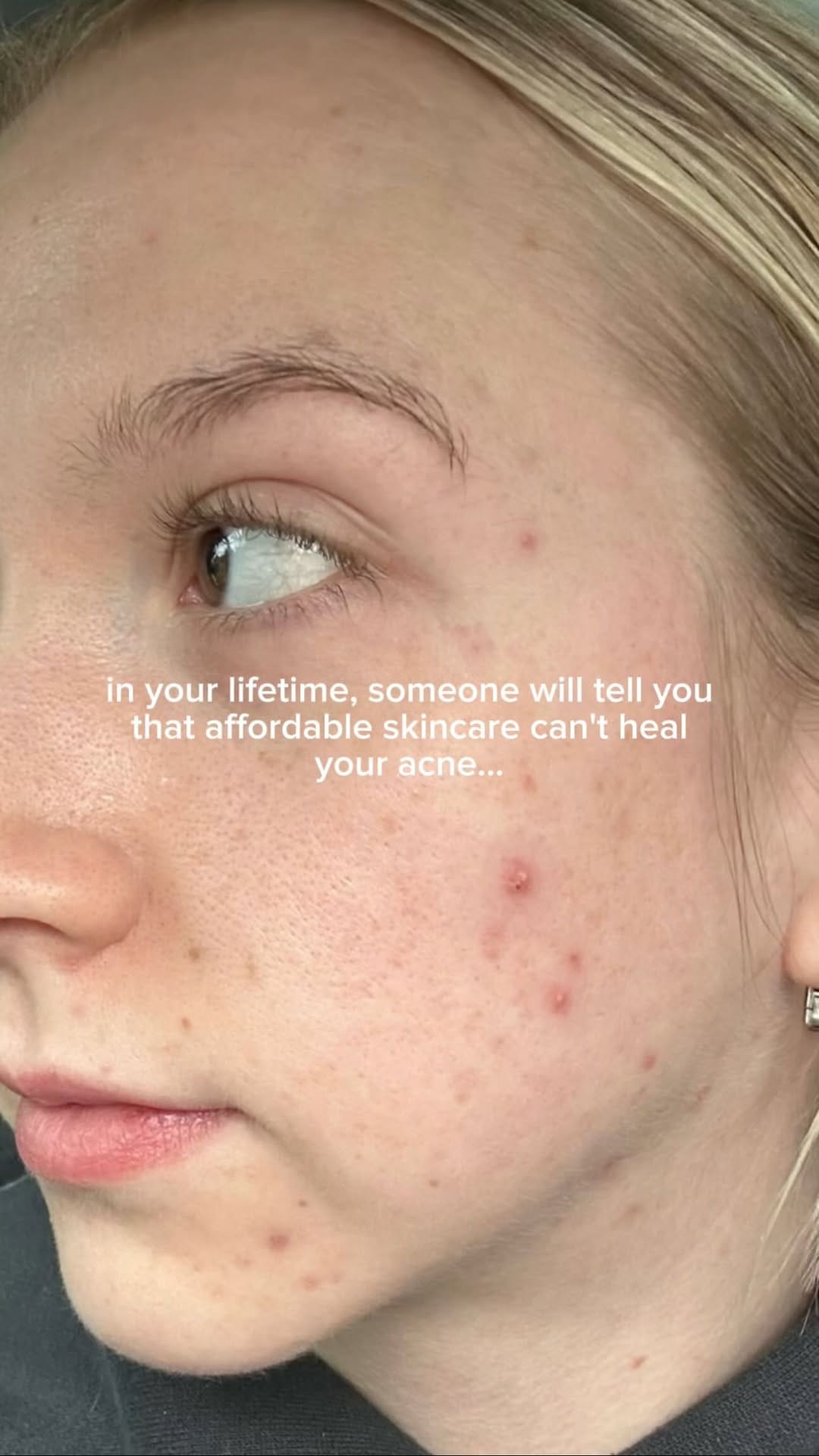 Post 7 by Skincare UGC on Instagram (video)