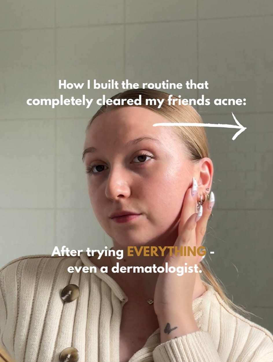 Post 10 by Skincare UGC on Instagram (carousel)