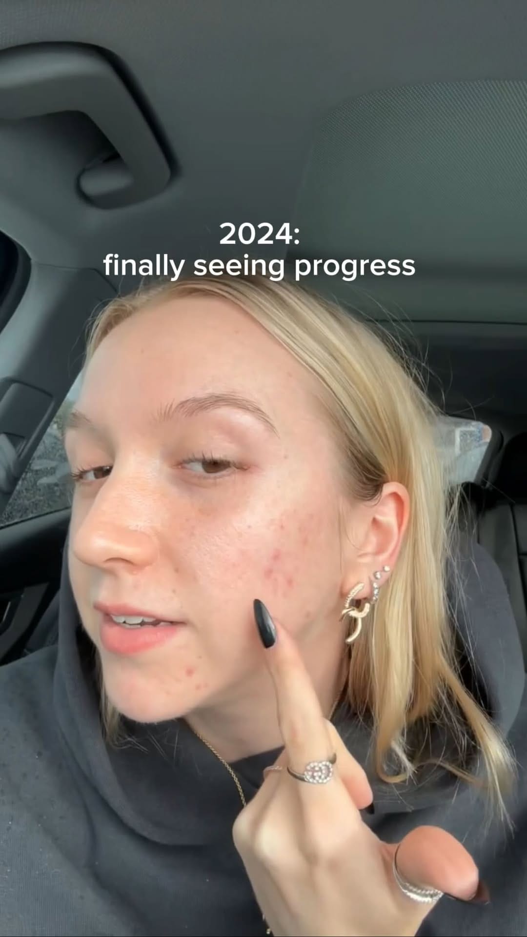 Post 5 by Skincare UGC on Instagram (video)