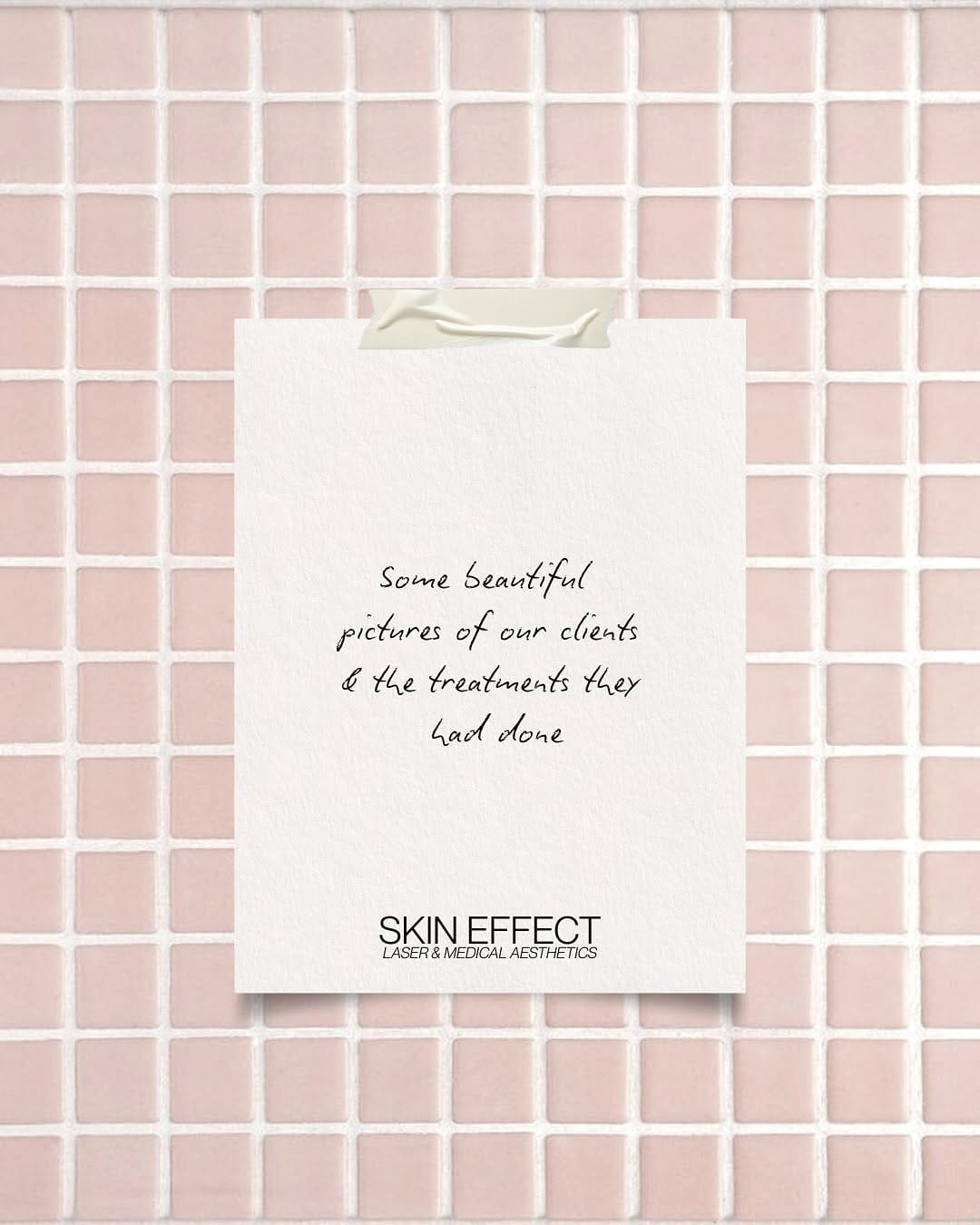 Post 6 by Skin Effect | YEG Medical Aesthetics Spa on Instagram (carousel)
