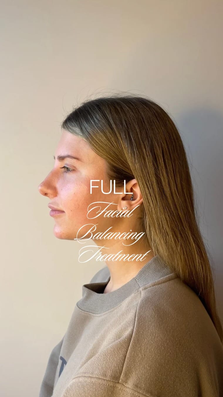 Post 8 by Skin Effect | YEG Medical Aesthetics Spa on Instagram (video)