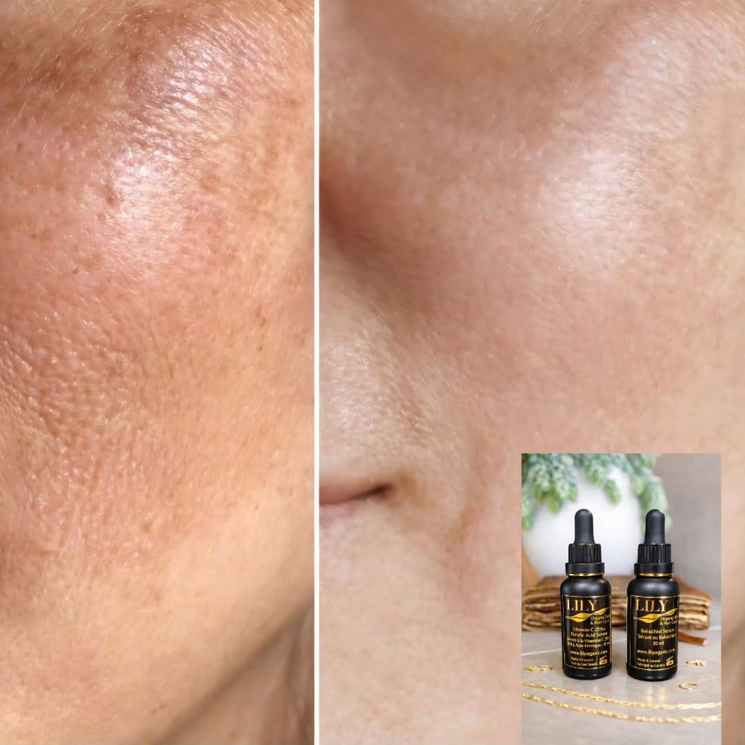 Post 4 by Lily Organic Skincare on Instagram (carousel)