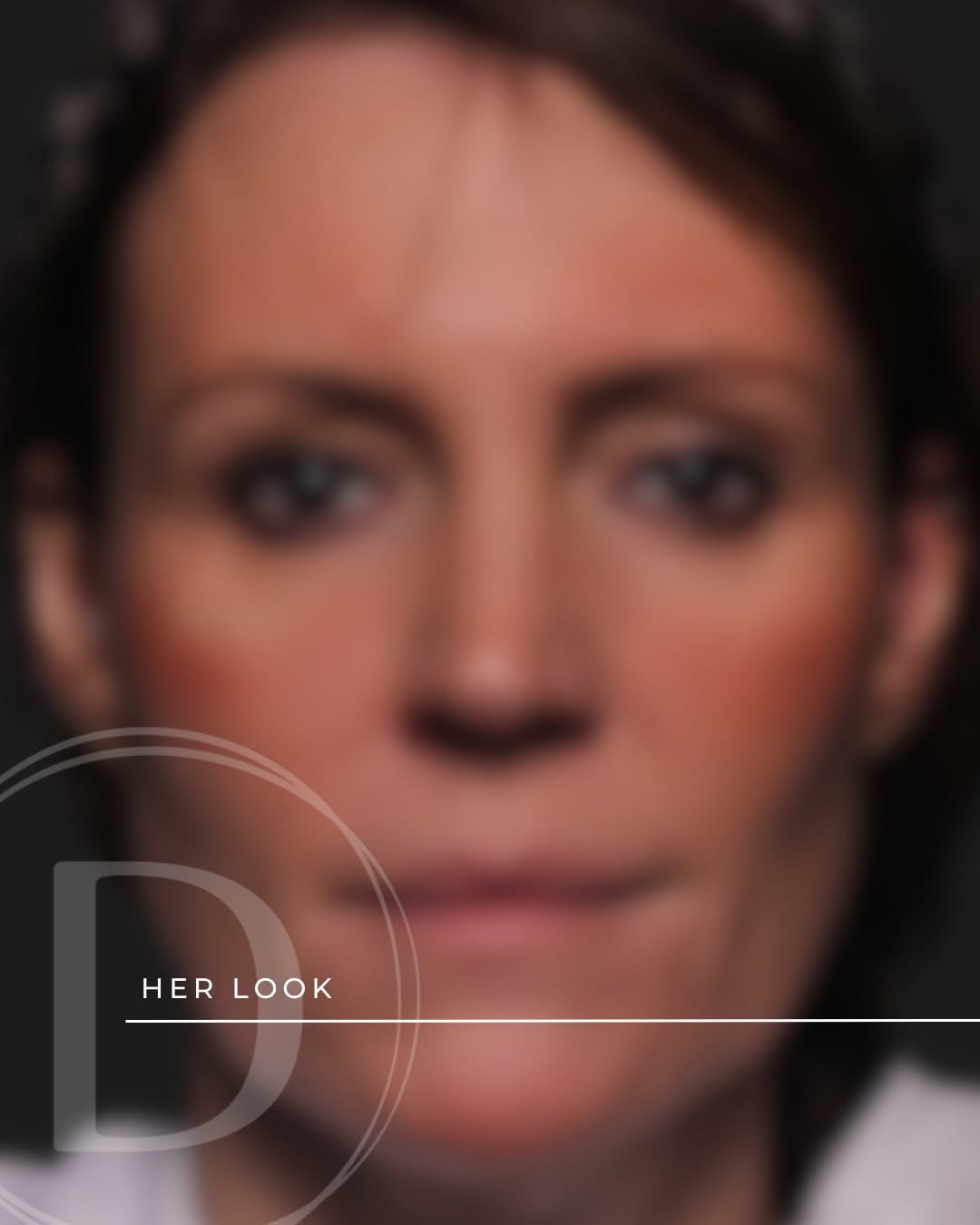 Post 7 by Cosmetic Dermatology & Medical Aesthetics on Instagram (carousel)
