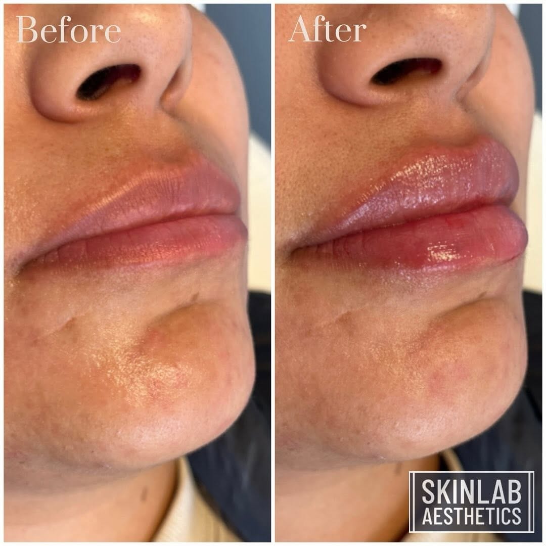 Post 6 by 💉SᴋɪɴLᴀʙ Aᴇsᴛʜᴇᴛɪᴄs💉 on Instagram (image)