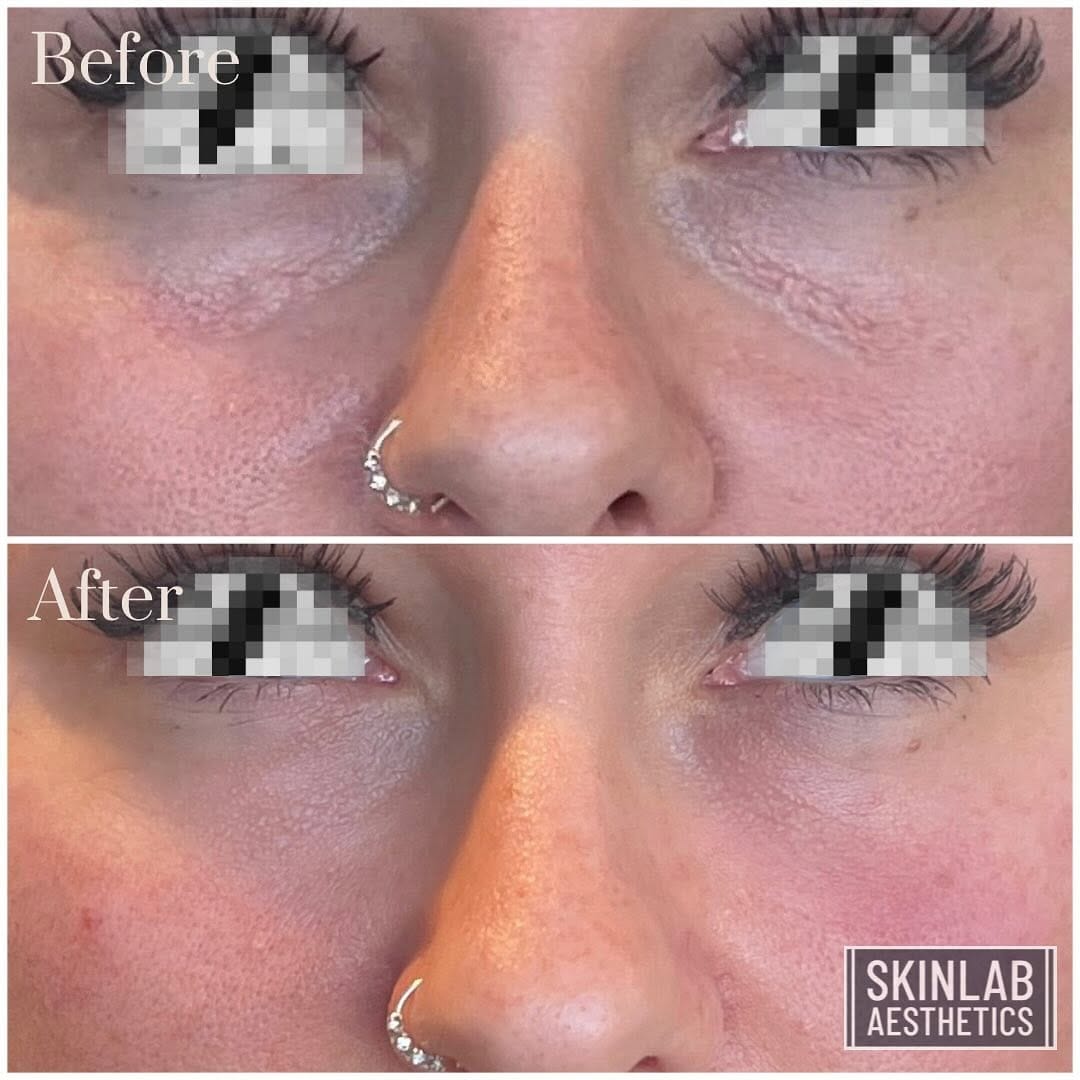 Post 4 by 💉SᴋɪɴLᴀʙ Aᴇsᴛʜᴇᴛɪᴄs💉 on Instagram (image)