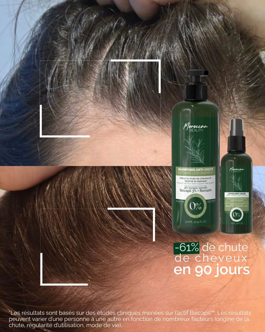 Post 1 by Moroccan Beauty® | 🇲🇦 Skincare on Instagram (carousel)