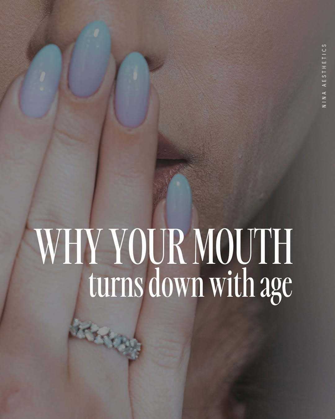 Post 3 by NINA Aesthetics - CALGARY ADVANCED MEDICAL AESTHETICS on Instagram (image)