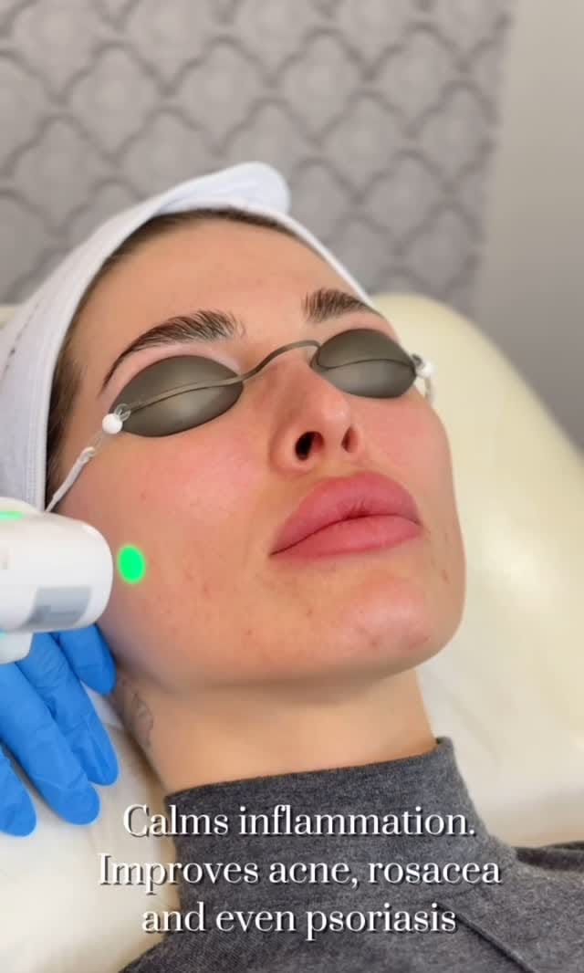 Post 6 by SKIN INSTITUTE | FILLER • FACIALS • WELLNESS on Instagram (video)
