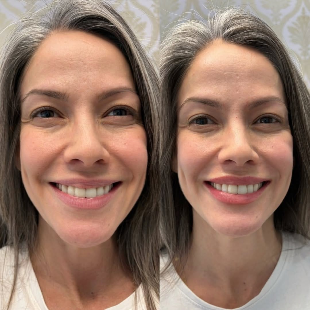 Post 2 by SKIN INSTITUTE | FILLER • FACIALS • WELLNESS on Instagram (carousel)