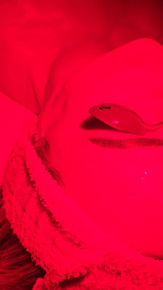 Post 7 by Skin Revival Skincare Clinic | Laser & Facials | Cosmetics on Instagram (video)