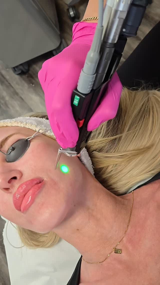 Post 4 by Skin Revival Skincare Clinic | Laser & Facials | Cosmetics on Instagram (video)