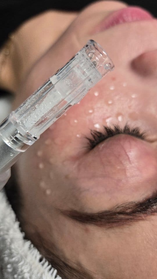 Post 2 by Skin Revival Skincare Clinic | Laser & Facials | Cosmetics on Instagram (video)