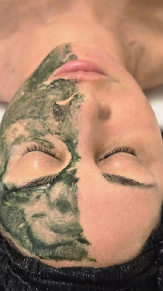 Post 8 by Skin Revival Skincare Clinic | Laser & Facials | Cosmetics on Instagram (video)