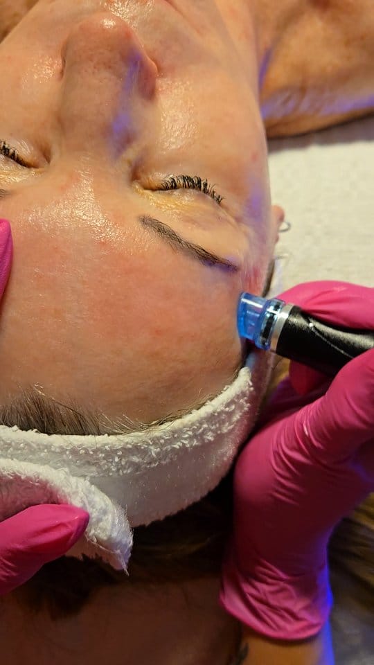 Post 5 by Skin Revival Skincare Clinic | Laser & Facials | Cosmetics on Instagram (video)