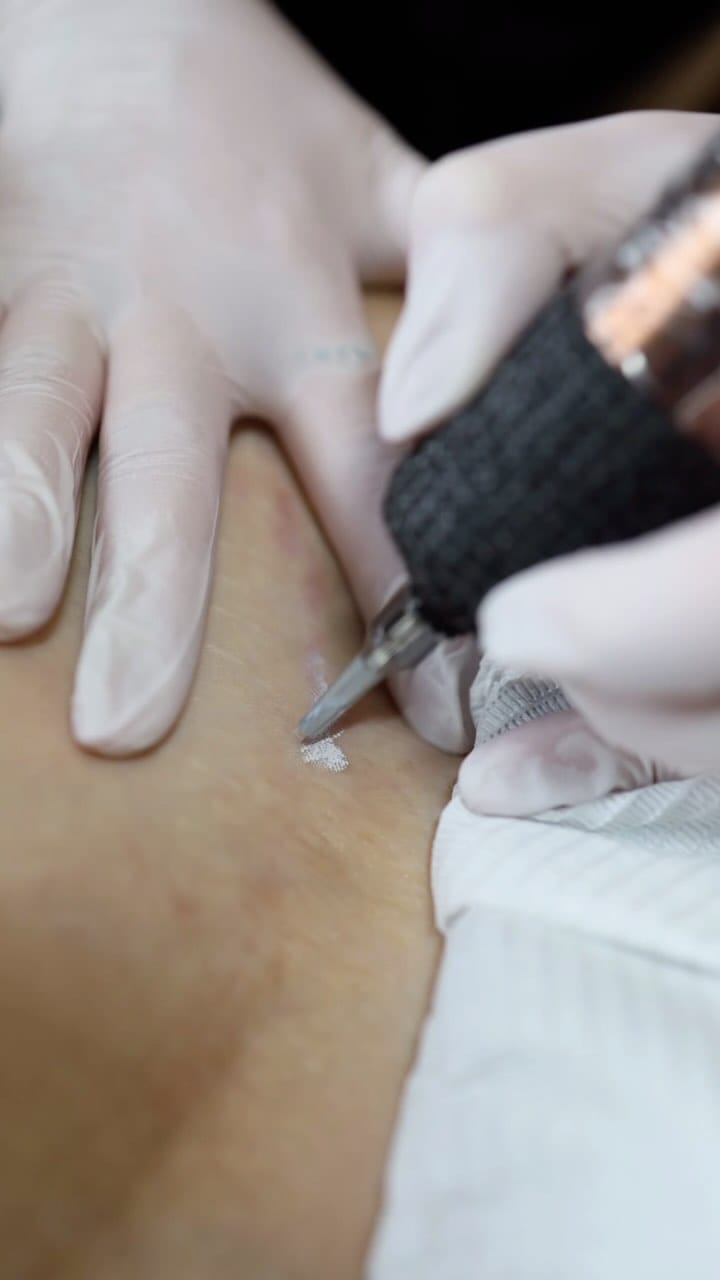 Post 2 by FINE LINE TATTOOS•COSMETIC TATTOO•SCAR CAMOUFLAGE on Instagram (video)