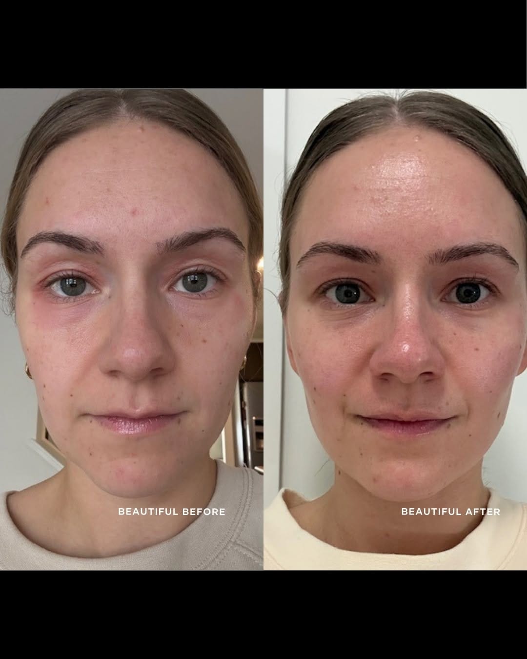 Post 2 by Om Organics - 100% Natural Skincare on Instagram (carousel)