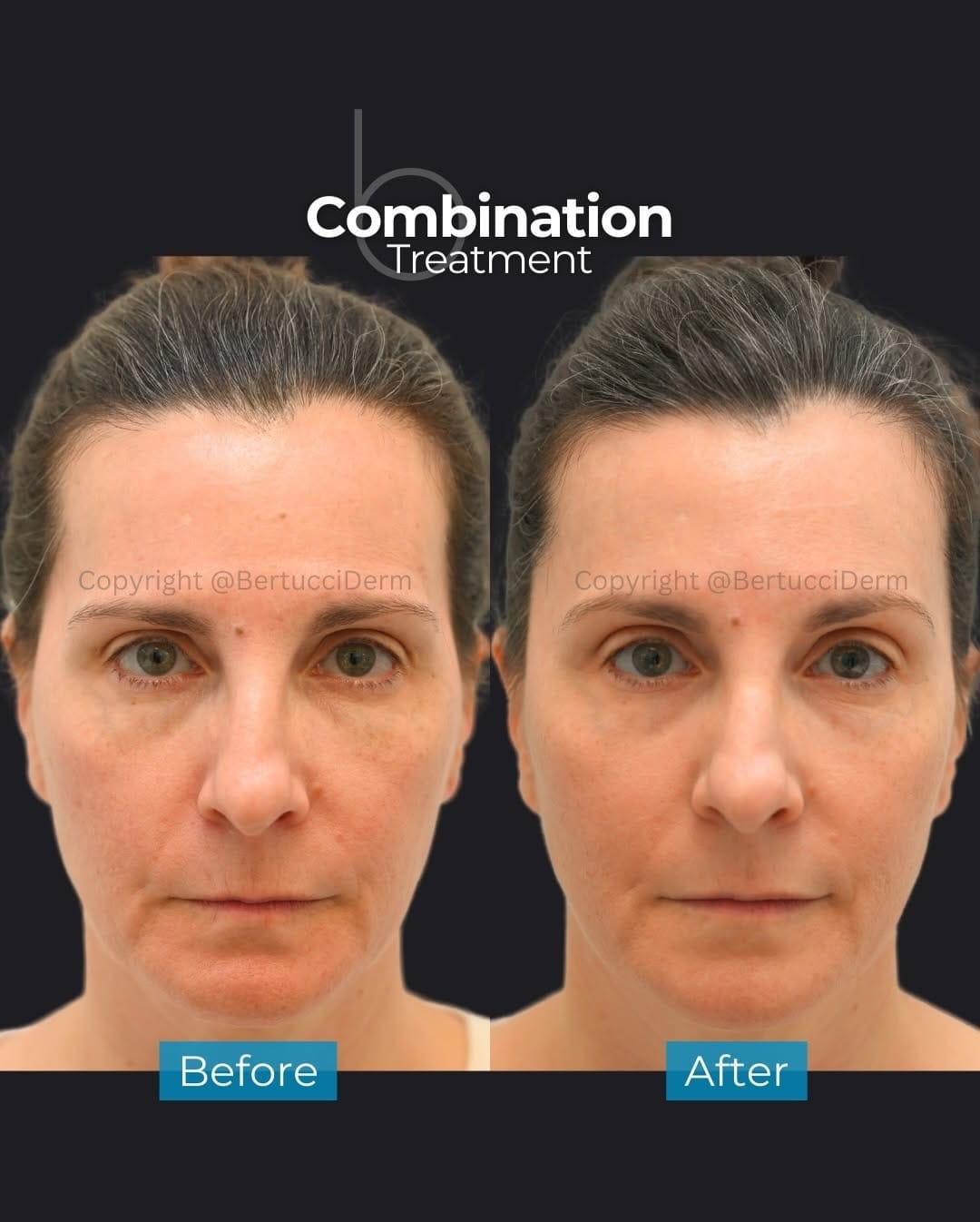 Post 1 by Vince Bertucci, MD, FRCPC, & Associates on Instagram (carousel)