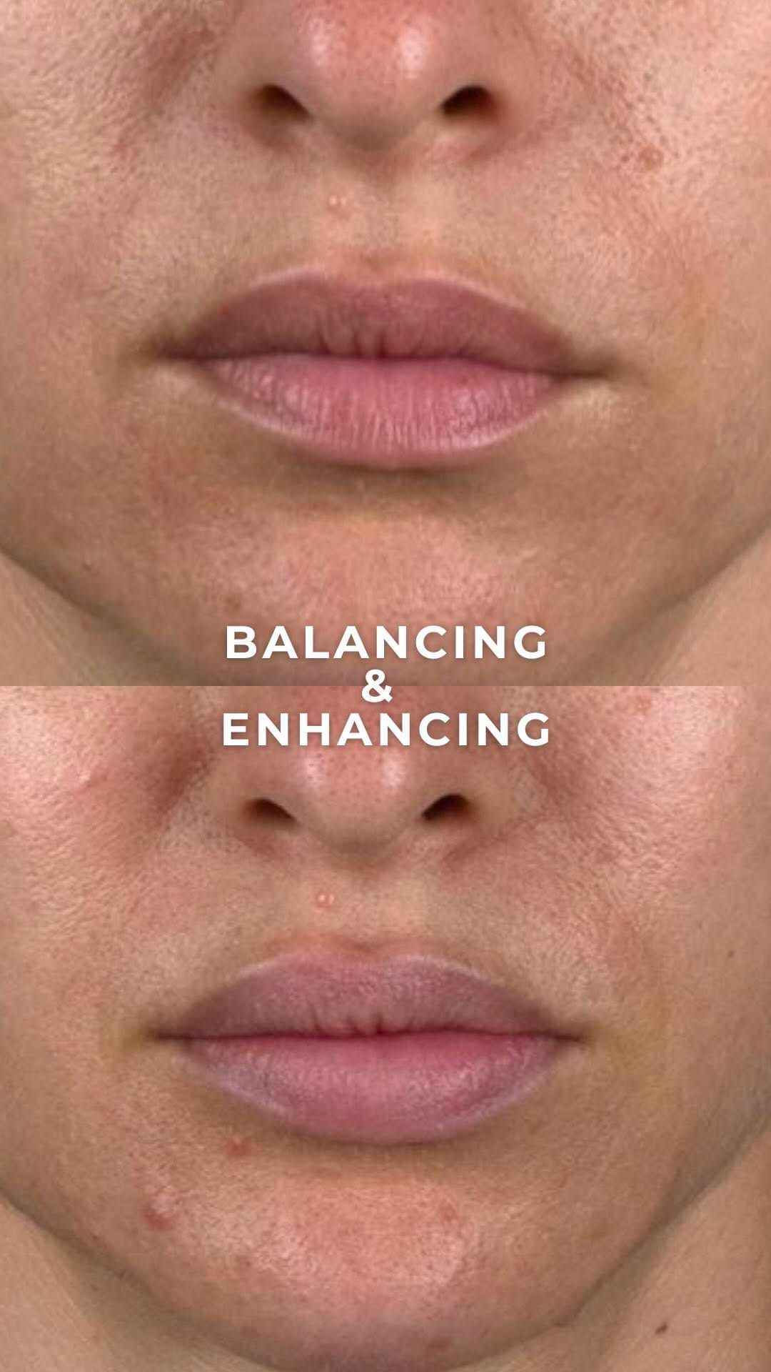 Post 4 by Vince Bertucci, MD, FRCPC, & Associates on Instagram (video)
