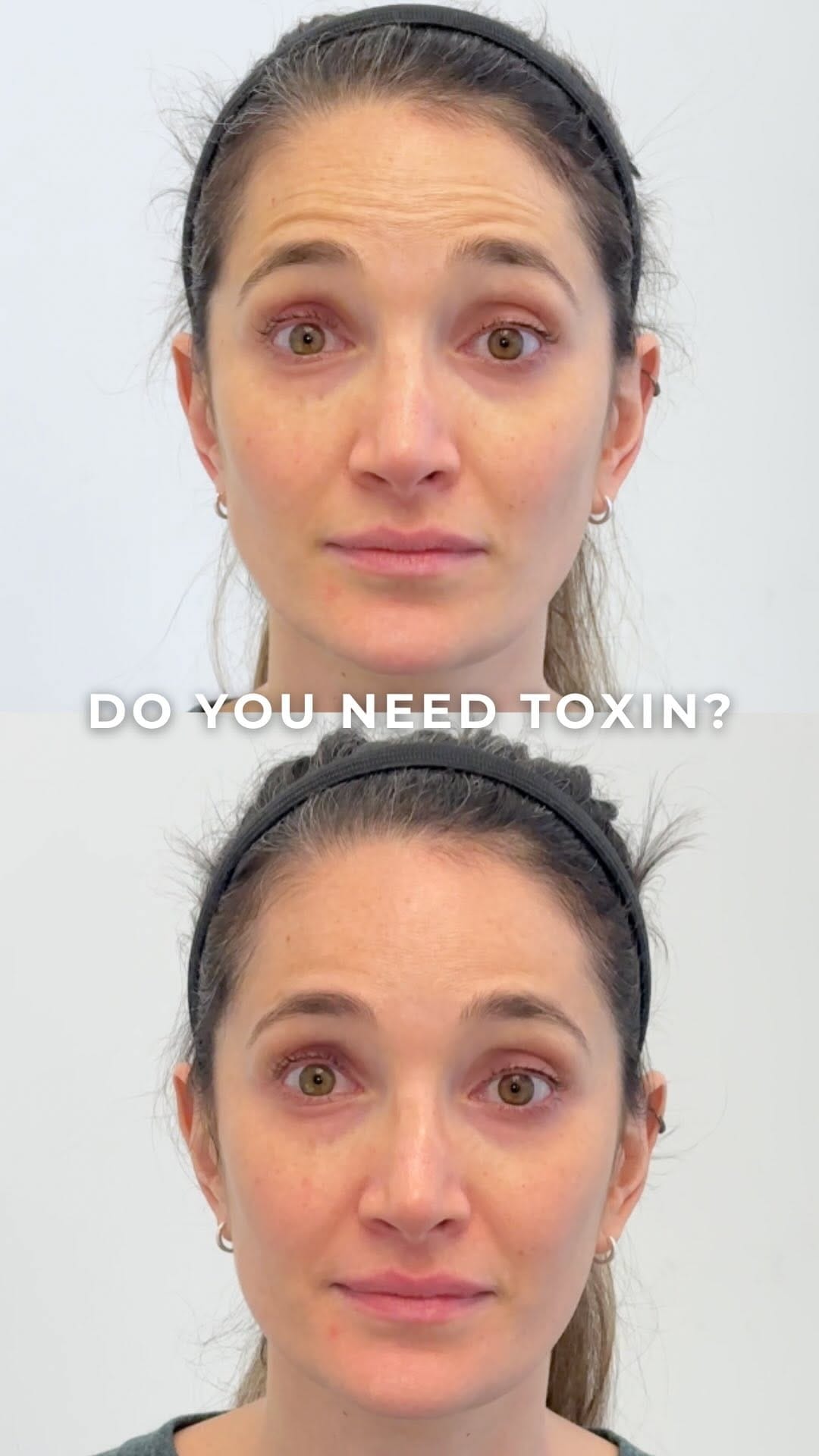 Post 3 by Vince Bertucci, MD, FRCPC, & Associates on Instagram (video)