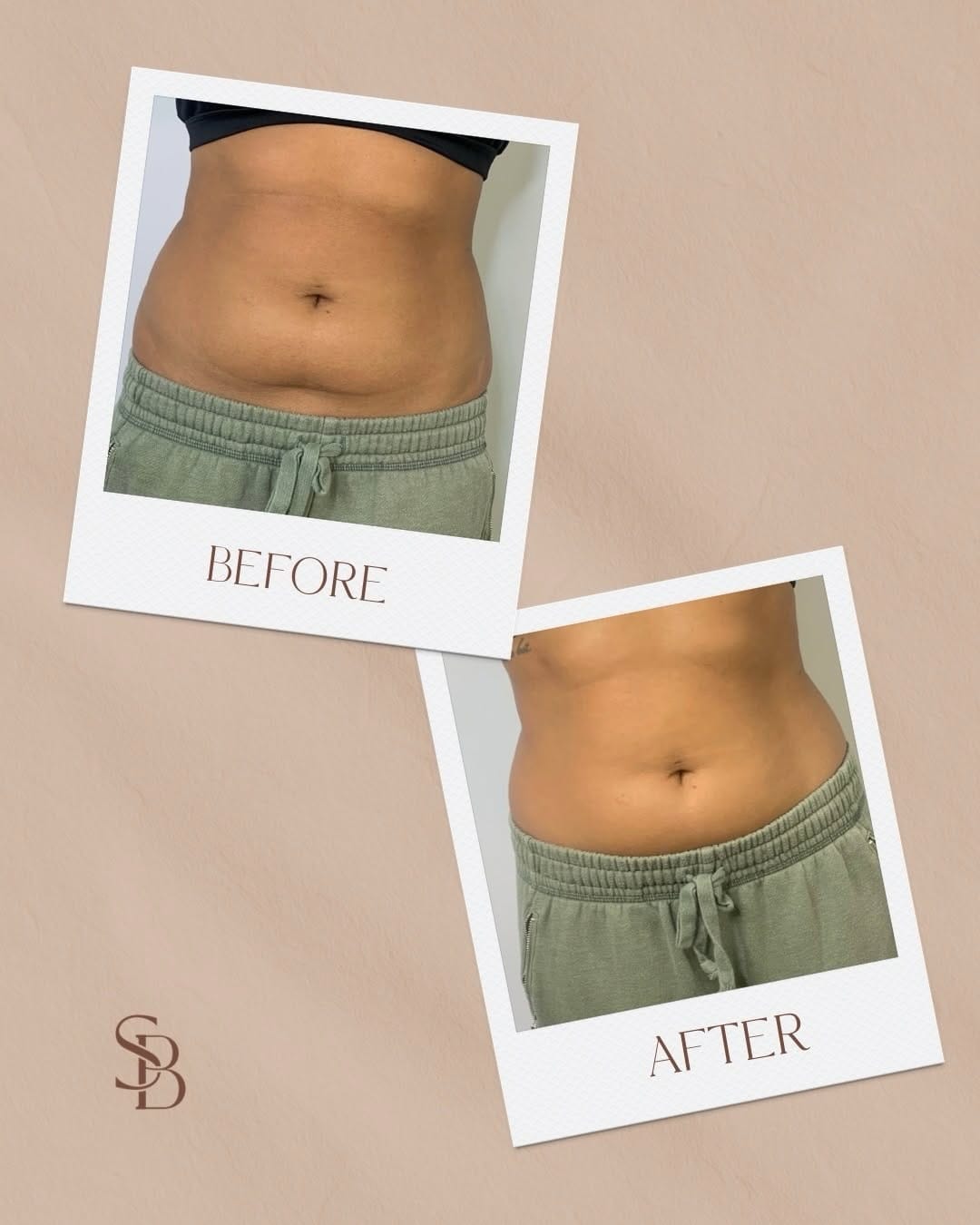 Post 1 by Schulz Beauty | Custom Spray Tans | Effortless Beauty on Instagram (carousel)