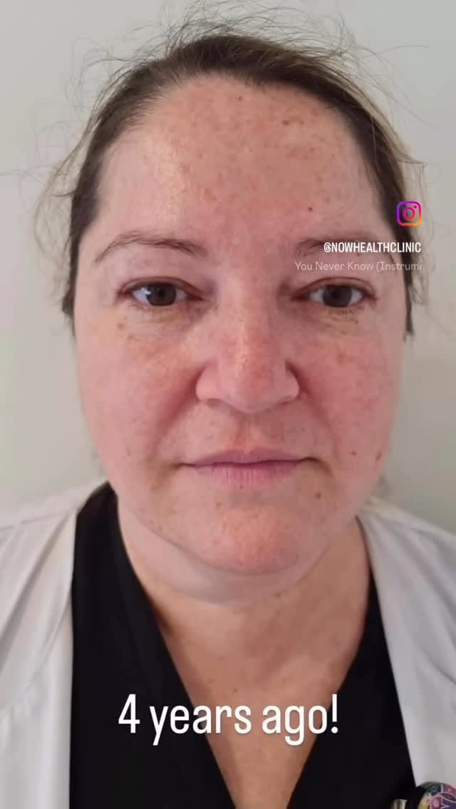 Post 3 by Botox.Lip Filler.Alastin.Dysport.PRP.PRF on Instagram (video)
