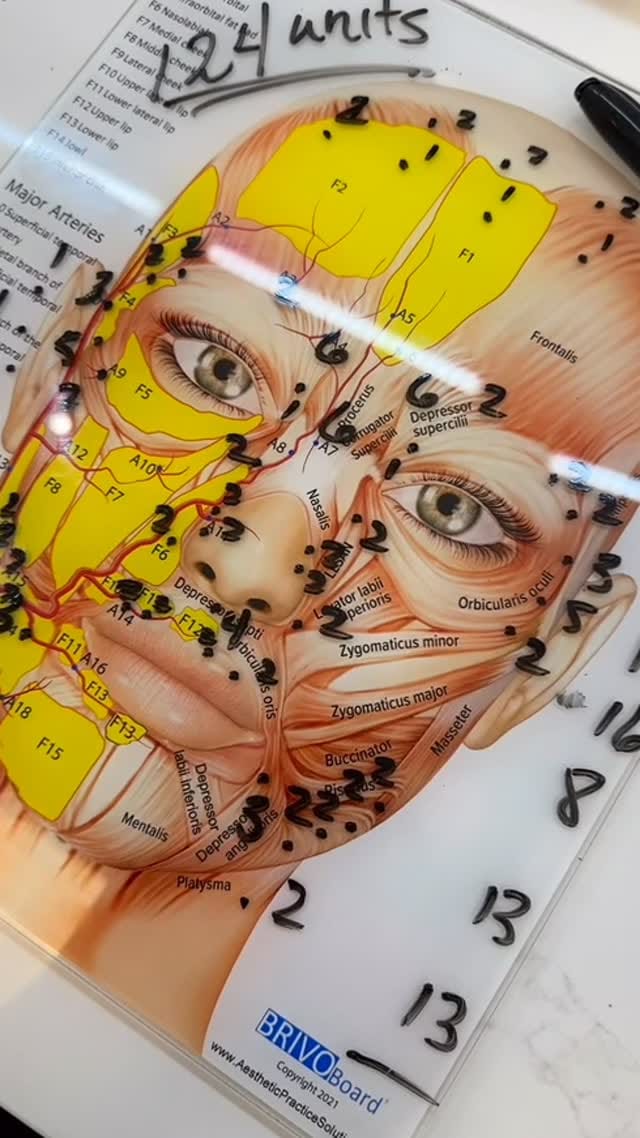 Post 5 by Botox.Lip Filler.Alastin.Dysport.PRP.PRF on Instagram (video)