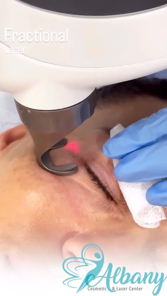 Post 7 by AlbanyCosmeticLaserCentre on Instagram (video)