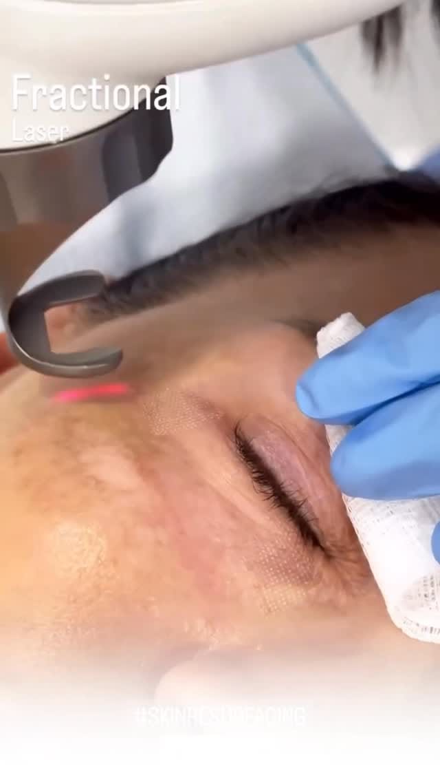 Post 9 by AlbanyCosmeticLaserCentre on Instagram (video)