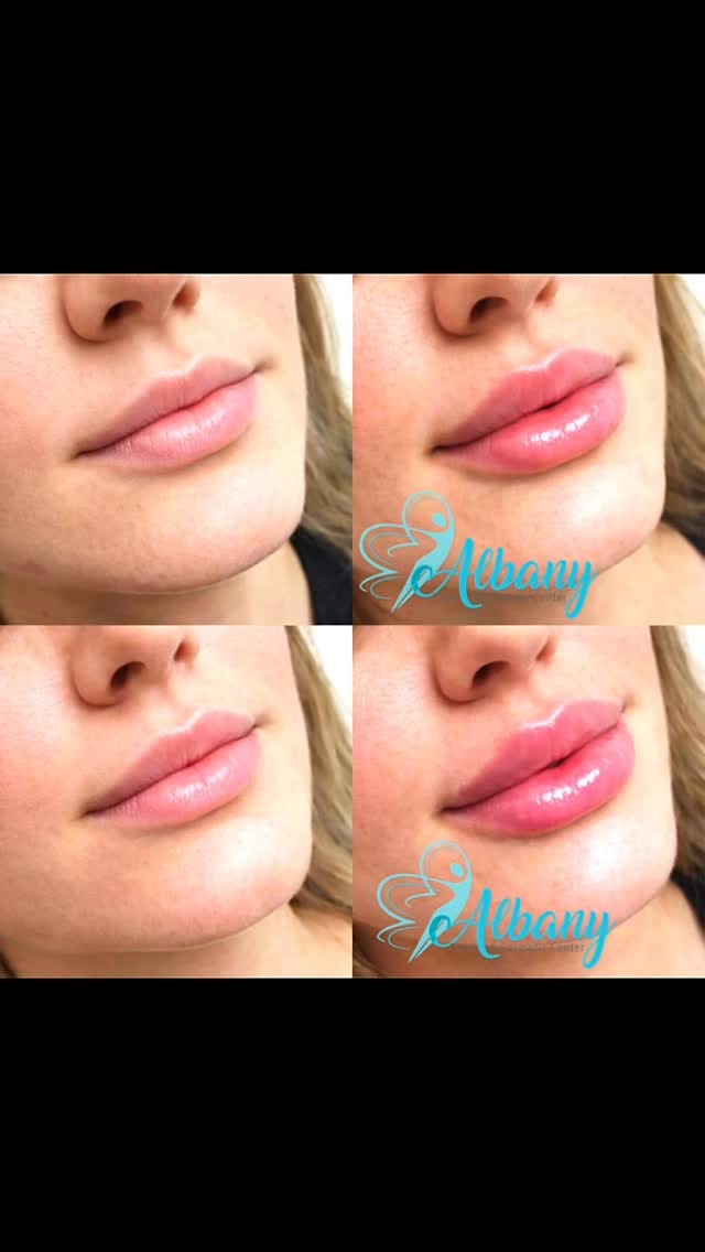 Post 10 by AlbanyCosmeticLaserCentre on Instagram (video)