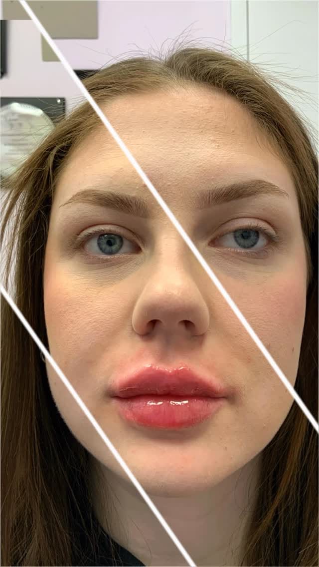 Post 4 by AlbanyCosmeticLaserCentre on Instagram (video)