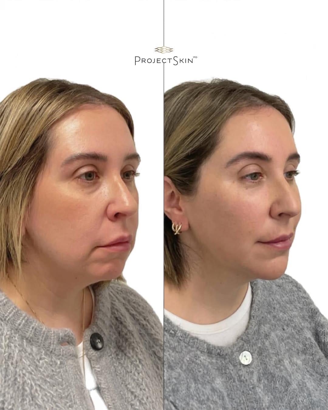 Post 1 by Project Skin MD Vancouver on Instagram (image)