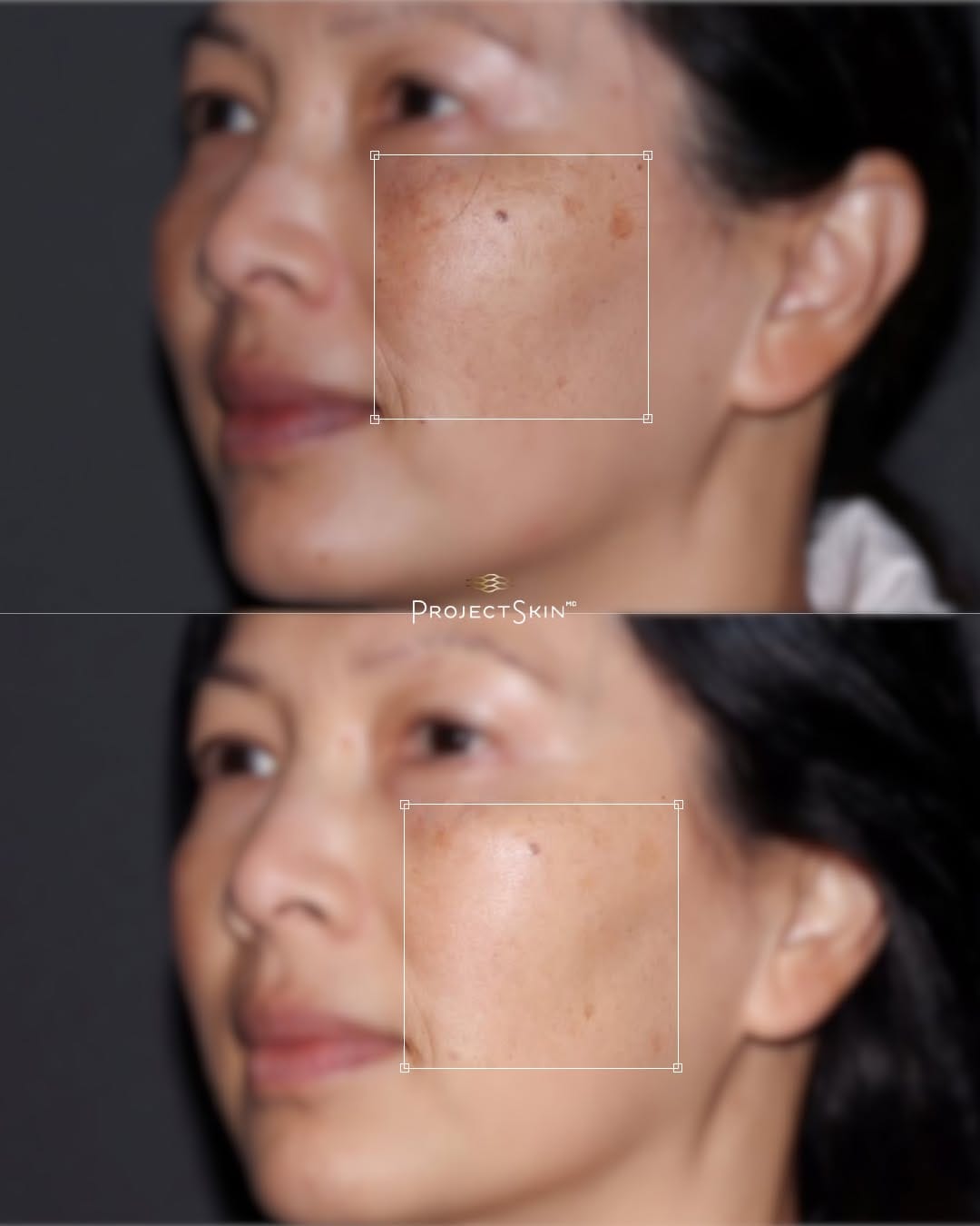 Post 3 by Project Skin MD Vancouver on Instagram (image)