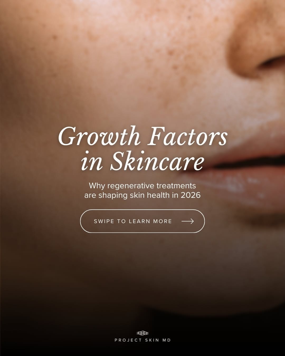 Post 4 by Project Skin MD Vancouver on Instagram (carousel)