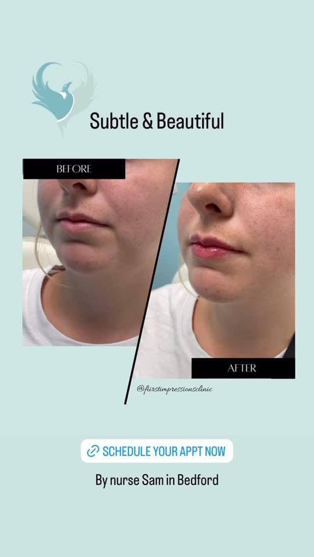 Post 1 by First Impressions Rejuvenation Clinic on Instagram (video)