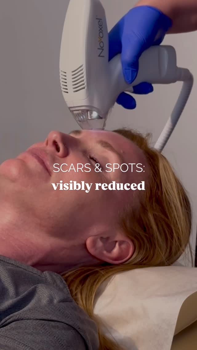 Post 10 by Rejuvenus Clinic of Aesthetics on Instagram (video)