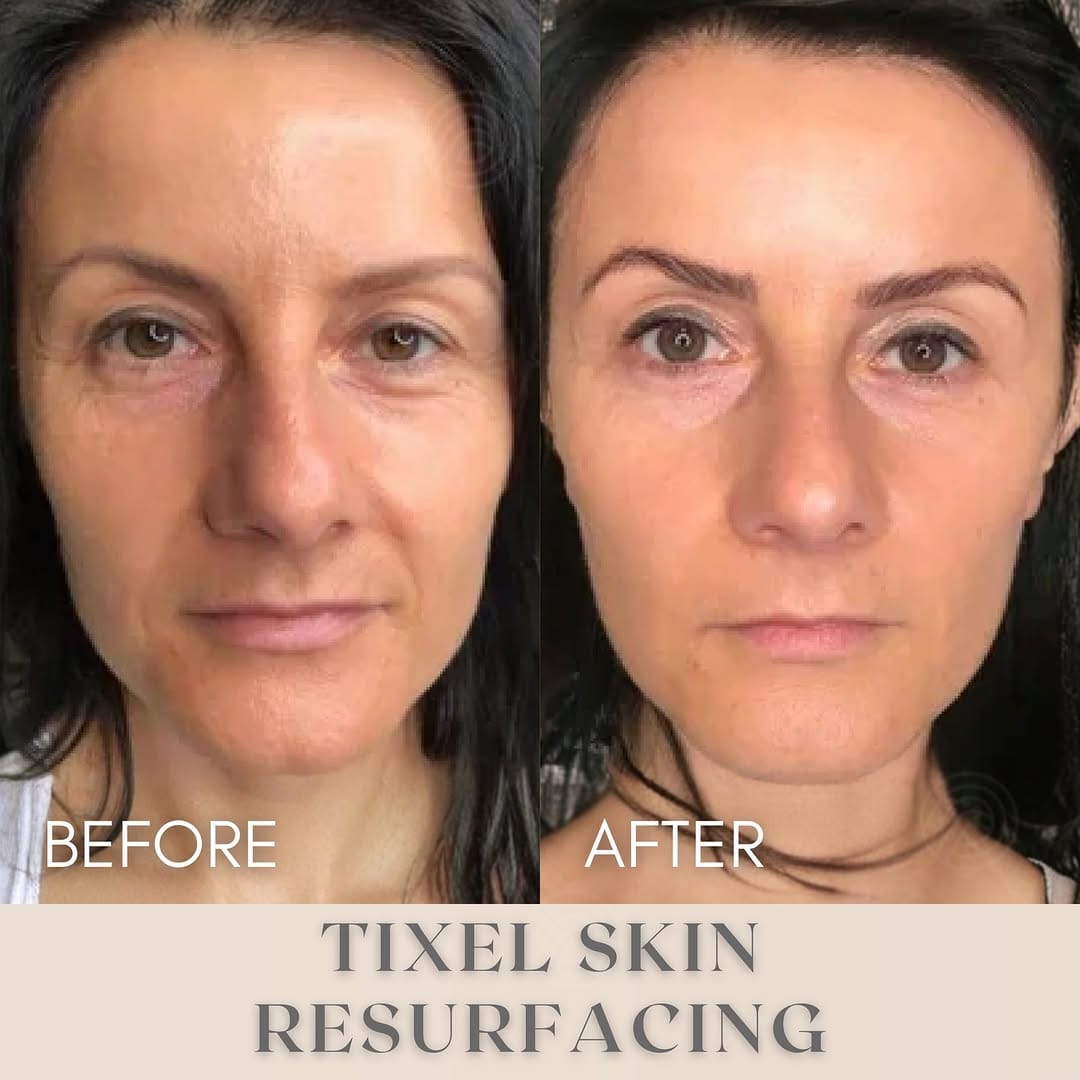 Post 9 by Rejuvenus Clinic of Aesthetics on Instagram (carousel)