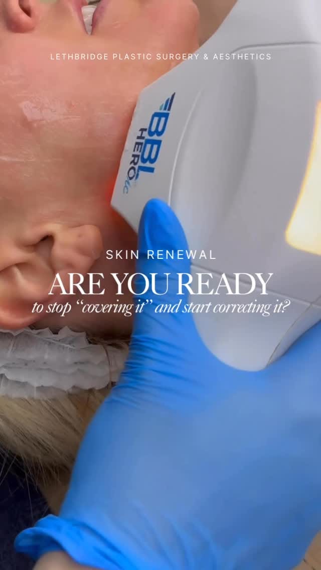 Post 3 by Lethbridge Plastic Surgery on Instagram (video)