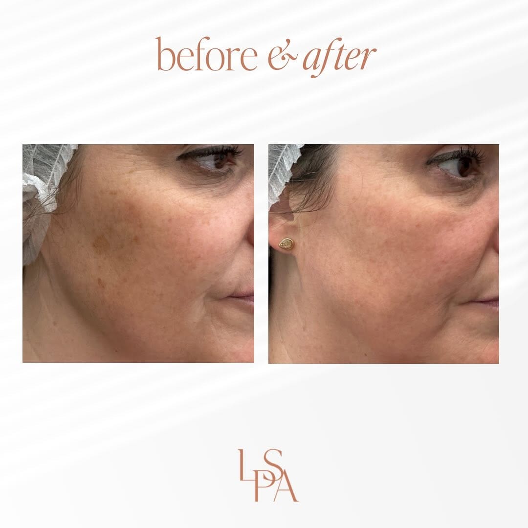Post 1 by Lethbridge Plastic Surgery on Instagram (image)