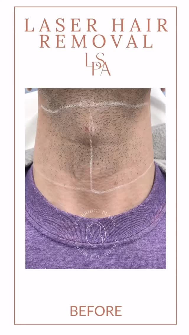 Post 5 by Lethbridge Plastic Surgery on Instagram (video)