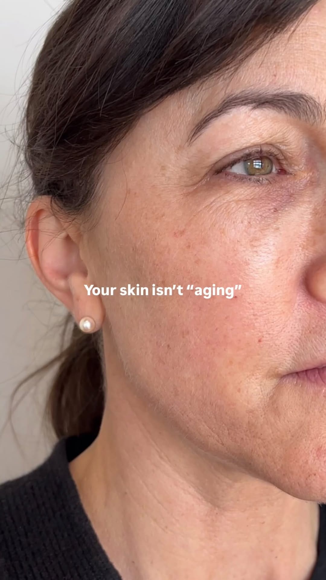 Post 8 by DermaLux Medical Aesthetics Spa on Instagram (video)